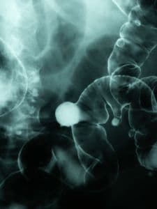 Homenagem ao Dia Nacional dos Ostomizados